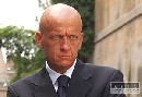 V Číne vysvetlili príčinu vzniku dedičnej plešatosti