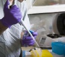 Laboratórium Humanplasma si prilepšovalo krvným dopingom