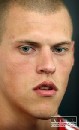  V Liverpoole nie s naden, e krtel chce hra proti echom